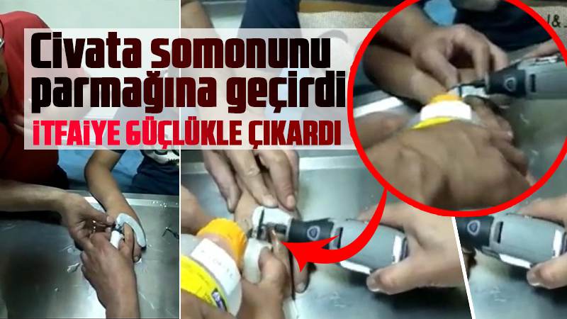 Parmağını cıvata somununa sıkıştırdı