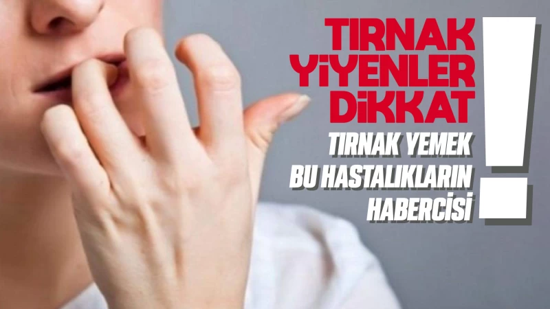 Tırnak yiyenler dikkat! Tırnak yemek bu hastalıkların habercisi