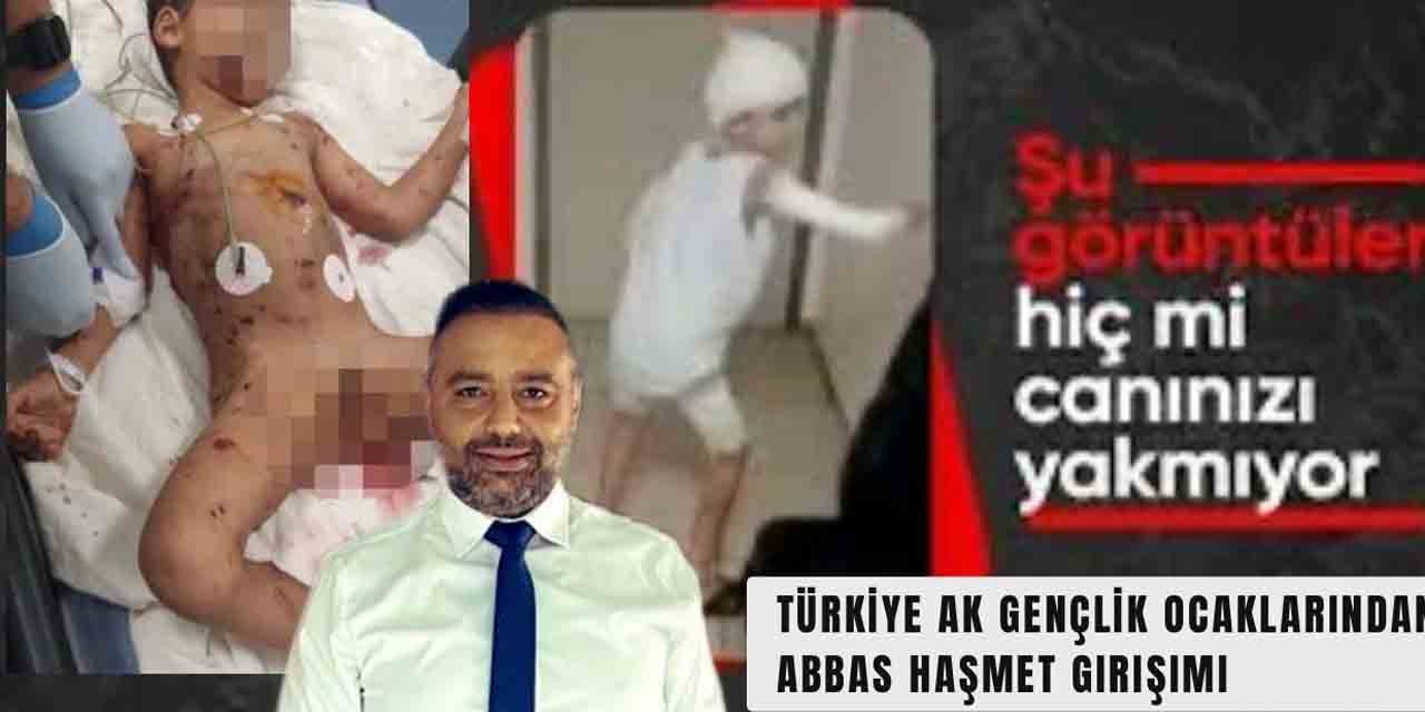 Türkiye’de Başıboş Köpek Sorunu: Abbas Haşmet Yoğun Bakımda