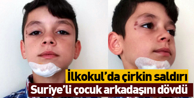 Okulda Cetvelli Saldırı