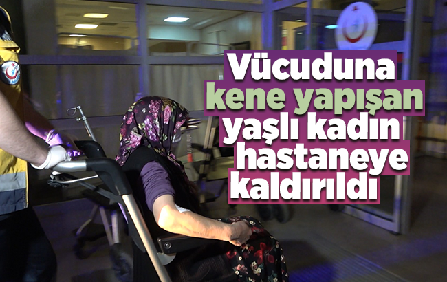 Kırıkkale’de vücuduna kene yapışan kadın hastaneye kaldırıldı